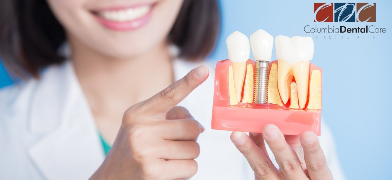Columbia Dental Care Kissimmee Root Canal Dentists